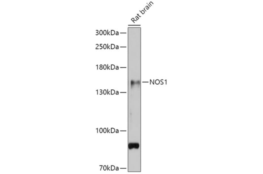 Western Blot - Anti-nNOS (neuronal) Antibody (A88335) - Antibodies.com