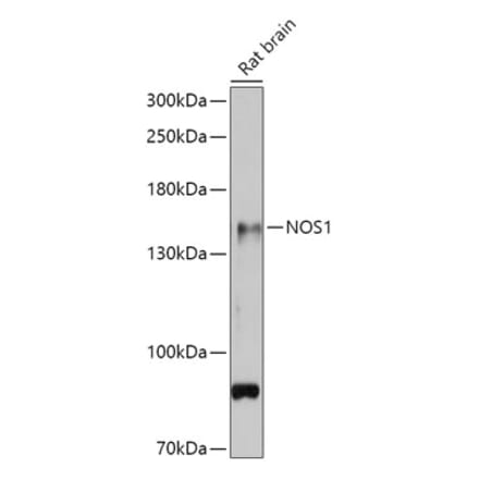 Western Blot - Anti-nNOS (neuronal) Antibody (A88335) - Antibodies.com