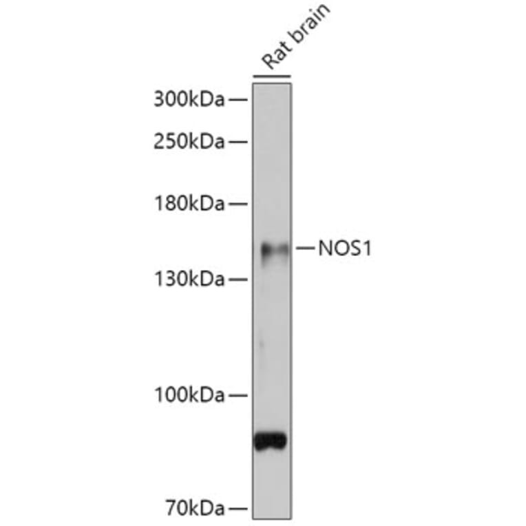 Western Blot - Anti-nNOS (neuronal) Antibody (A88335) - Antibodies.com