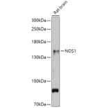 Western Blot - Anti-nNOS (neuronal) Antibody (A88335) - Antibodies.com