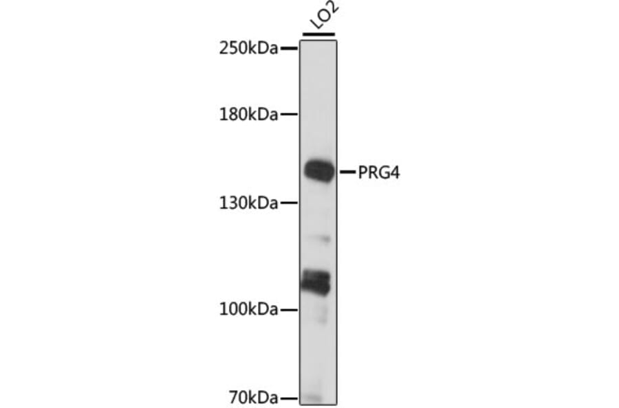 Western Blot - Anti-Lubricin/MSF Antibody (A88336) - Antibodies.com
