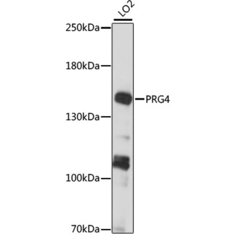 Western Blot - Anti-Lubricin/MSF Antibody (A88336) - Antibodies.com