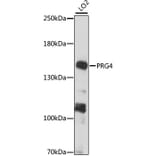 Western Blot - Anti-Lubricin/MSF Antibody (A88336) - Antibodies.com