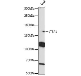 Western Blot - Anti-LTBP1 Antibody (A88337) - Antibodies.com