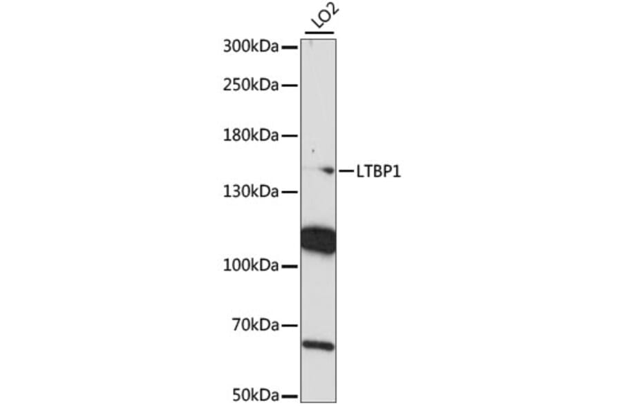 Western Blot - Anti-LTBP1 Antibody (A88337) - Antibodies.com