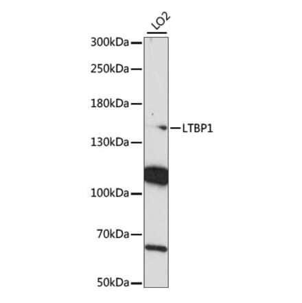 Western Blot - Anti-LTBP1 Antibody (A88337) - Antibodies.com
