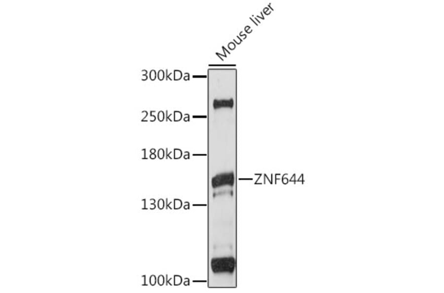 Western Blot - Anti-ZNF644 Antibody (A88338) - Antibodies.com