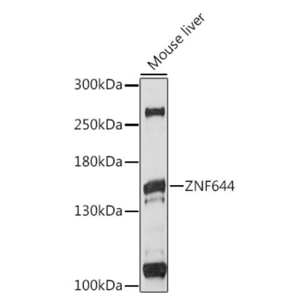 Western Blot - Anti-ZNF644 Antibody (A88338) - Antibodies.com