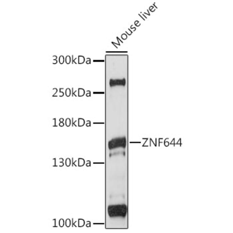 Western Blot - Anti-ZNF644 Antibody (A88338) - Antibodies.com