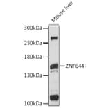 Western Blot - Anti-ZNF644 Antibody (A88338) - Antibodies.com