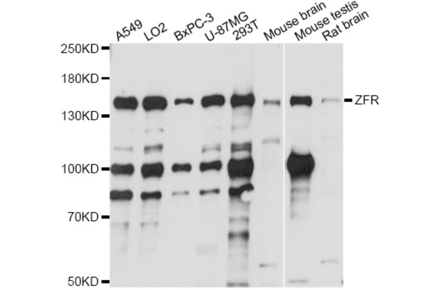Western Blot - Anti-ZFR Antibody (A14281) - Antibodies.com