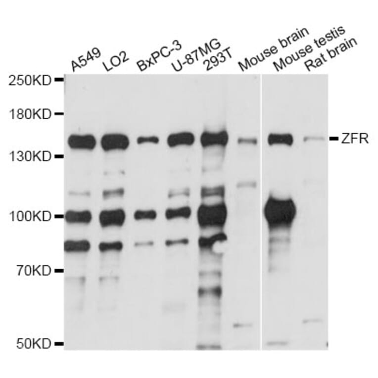 Western Blot - Anti-ZFR Antibody (A14281) - Antibodies.com
