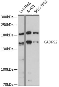 Western blot analysis of extracts of various cell lines, using Anti-CADPS2 Antibody (A13821) at 1:3000 dilution.
Secondary antibody: Goat Anti-Rabbit IgG (H+L) (HRP) (AS014) at 1:10,000 dilution.
Lysates / proteins: 25µg per lane.
Blocking buffer: 3% non-fat dry milk in TBST.
Detection: ECL Basic Kit (RM00020).
Exposure time: 90s.