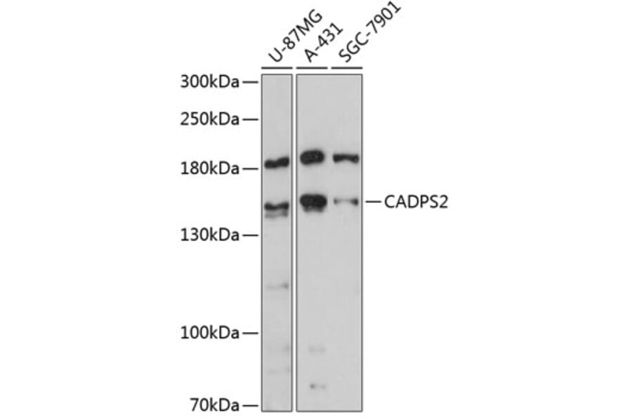 Western Blot - Anti-CAPS2 Antibody (A88340) - Antibodies.com