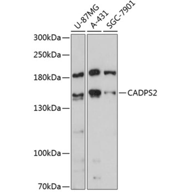 Western Blot - Anti-CAPS2 Antibody (A88340) - Antibodies.com