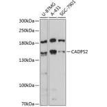 Western Blot - Anti-CAPS2 Antibody (A88340) - Antibodies.com