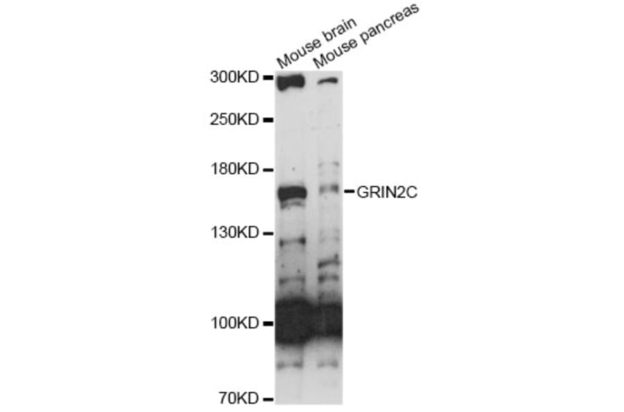 Western Blot - Anti-GRIN2C Antibody (A14241) - Antibodies.com