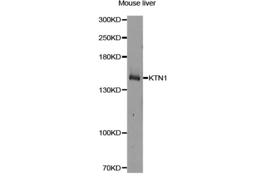 Western Blot - Anti-KTN1 Antibody (A14016) - Antibodies.com