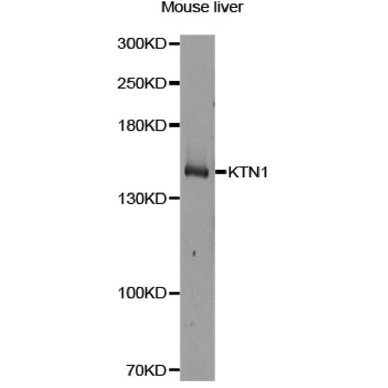 Western Blot - Anti-KTN1 Antibody (A14016) - Antibodies.com