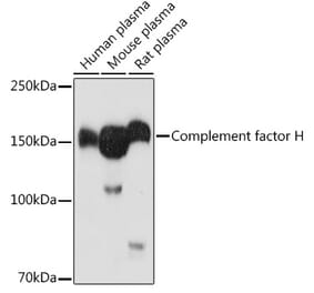 Western Blot - Anti-Factor H Antibody (A88343) - Antibodies.com