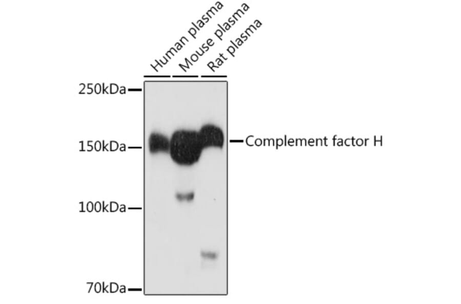 Western Blot - Anti-Factor H Antibody (A88343) - Antibodies.com