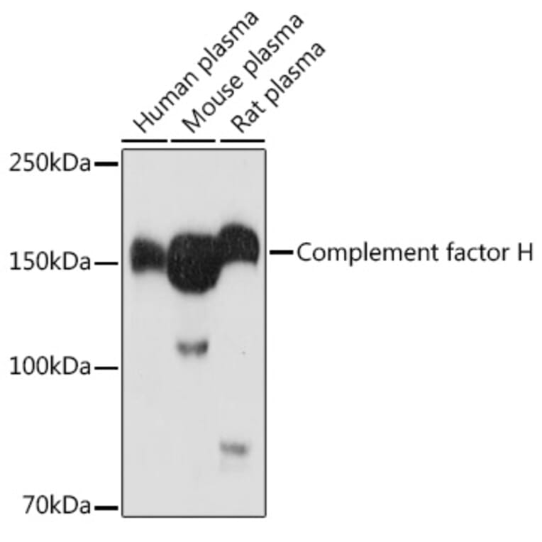 Western Blot - Anti-Factor H Antibody (A88343) - Antibodies.com
