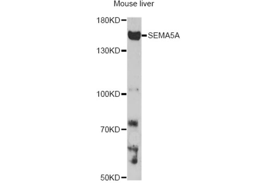 Western Blot - Anti-SEMA5A Antibody (A14817) - Antibodies.com