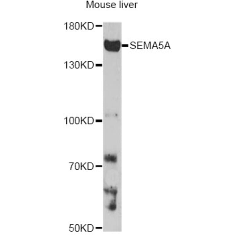 Western Blot - Anti-SEMA5A Antibody (A14817) - Antibodies.com