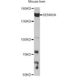 Western Blot - Anti-SEMA5A Antibody (A14817) - Antibodies.com