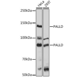 Western Blot - Anti-Palladin Antibody (A88346) - Antibodies.com