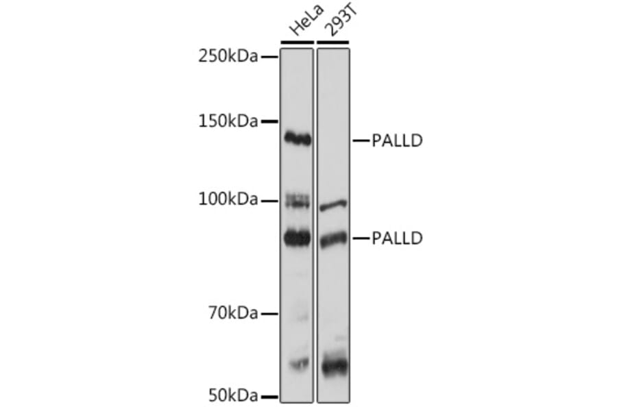 Western Blot - Anti-Palladin Antibody (A88346) - Antibodies.com