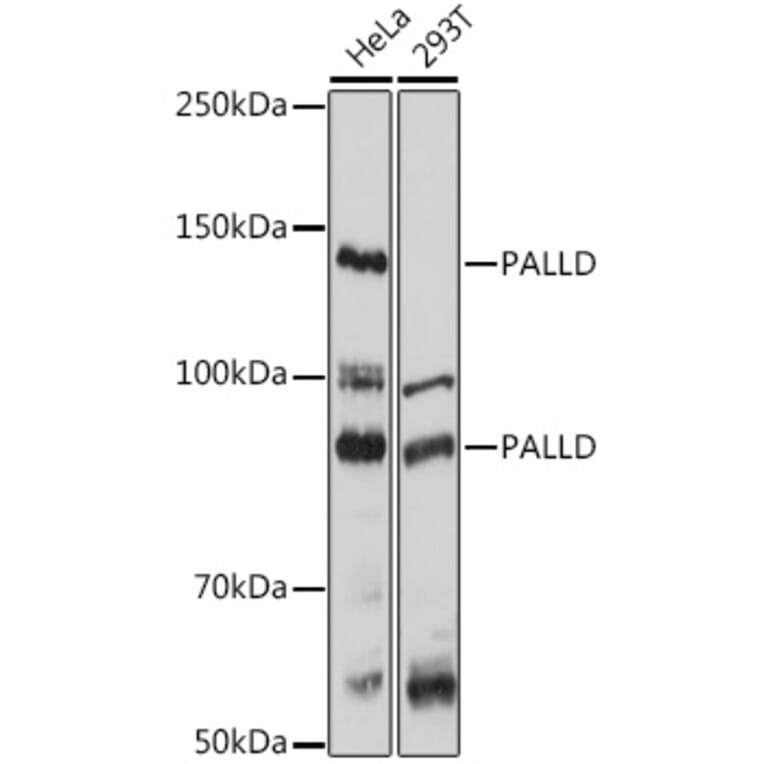 Western Blot - Anti-Palladin Antibody (A88346) - Antibodies.com