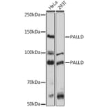 Western Blot - Anti-Palladin Antibody (A88346) - Antibodies.com
