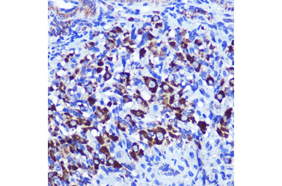 Immunohistochemistry - Anti-Palladin Antibody (A88346) - Antibodies.com
