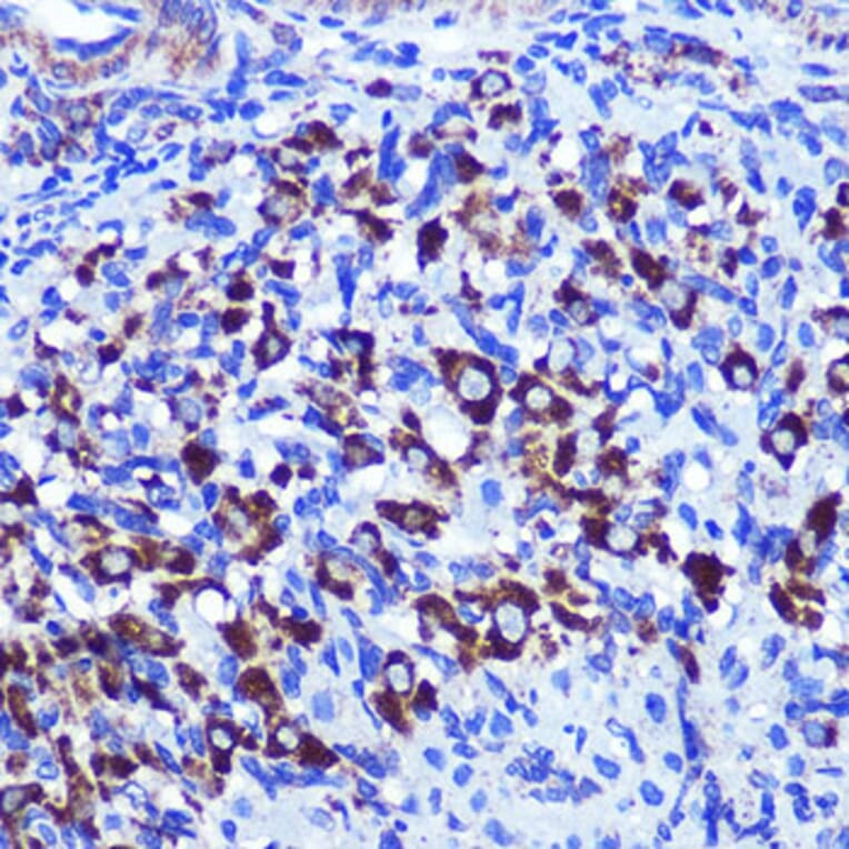 Immunohistochemistry - Anti-Palladin Antibody (A88346) - Antibodies.com