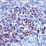 Immunohistochemistry - Anti-Palladin Antibody (A88346) - Antibodies.com