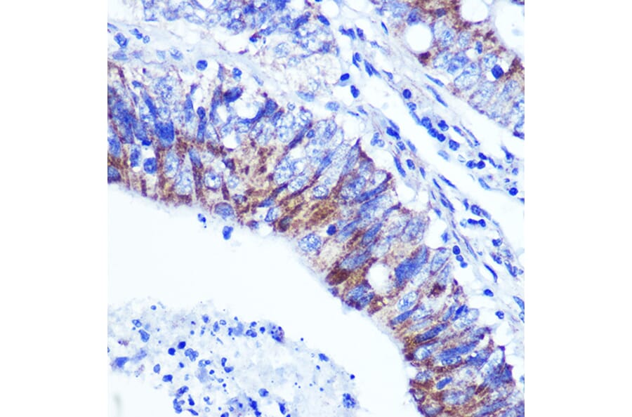 Immunohistochemistry - Anti-Palladin Antibody (A88346) - Antibodies.com