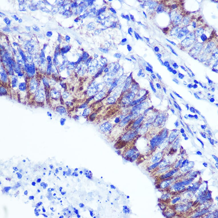 Immunohistochemistry - Anti-Palladin Antibody (A88346) - Antibodies.com