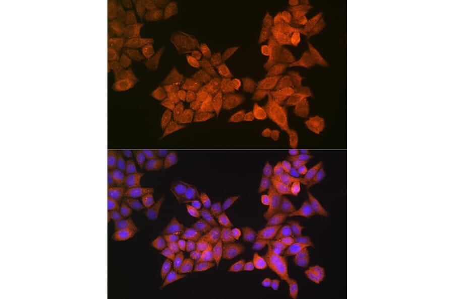 Immunofluorescence - Anti-Palladin Antibody (A88346) - Antibodies.com