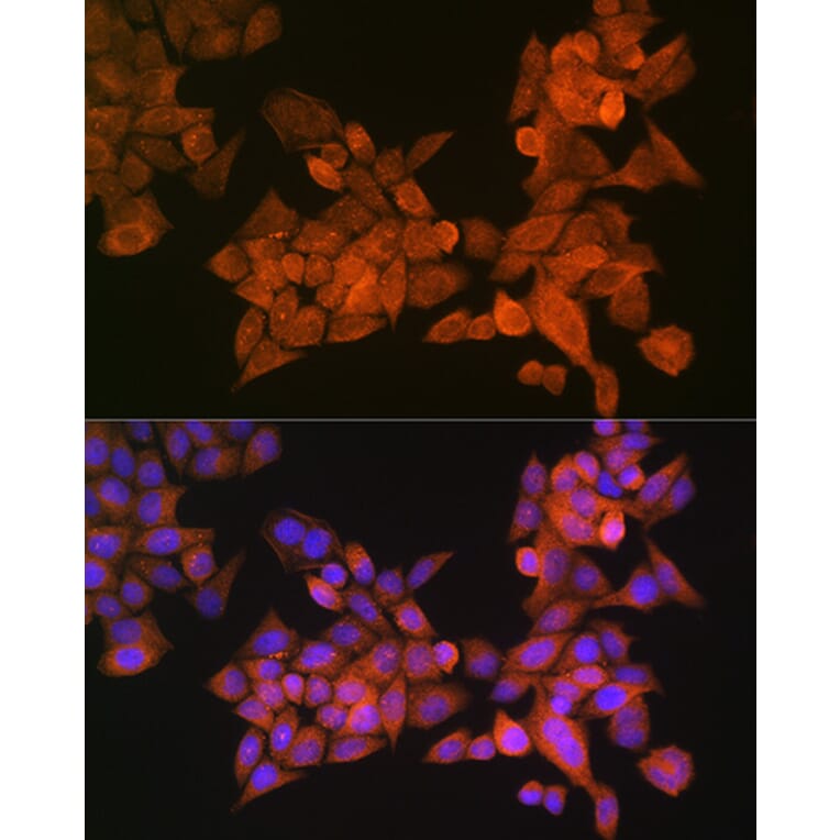 Immunofluorescence - Anti-Palladin Antibody (A88346) - Antibodies.com