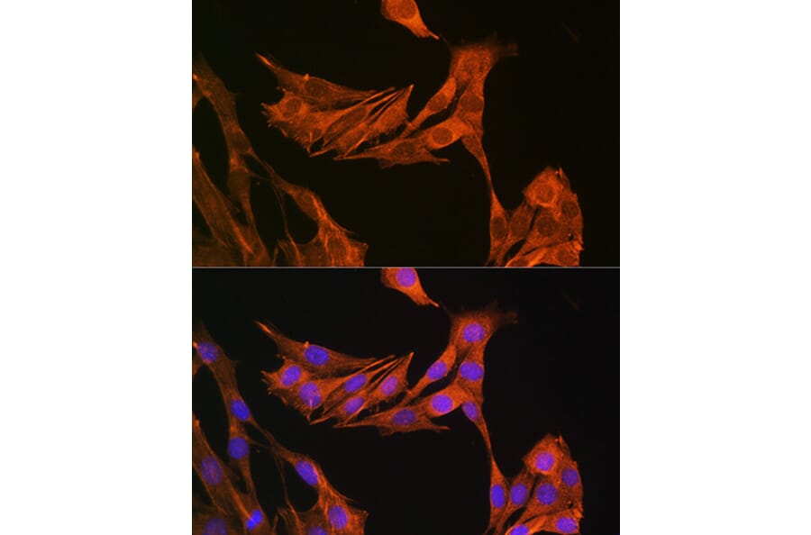 Immunofluorescence - Anti-Palladin Antibody (A88346) - Antibodies.com