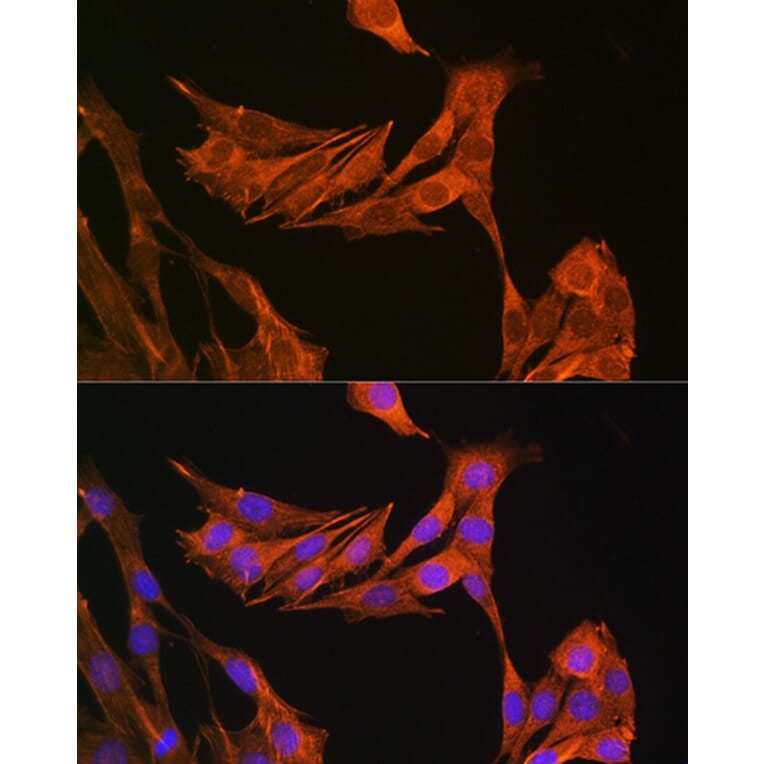 Immunofluorescence - Anti-Palladin Antibody (A88346) - Antibodies.com