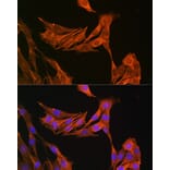 Immunofluorescence - Anti-Palladin Antibody (A88346) - Antibodies.com