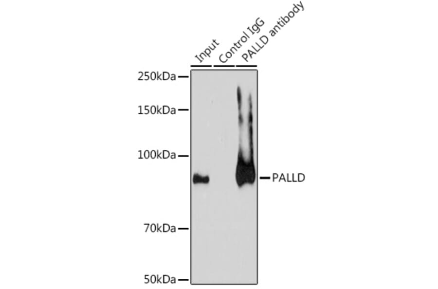 Western Blot - Anti-Palladin Antibody (A88346) - Antibodies.com