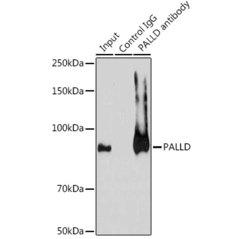 Western Blot - Anti-Palladin Antibody (A88346) - Antibodies.com