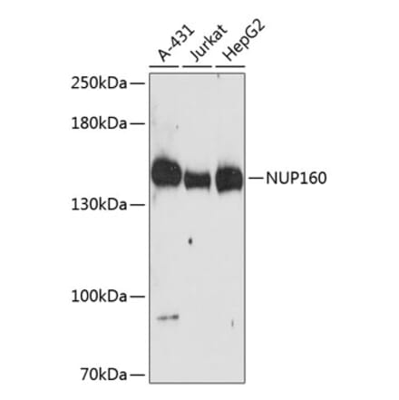 Western Blot - Anti-NUP160 Antibody (A88347) - Antibodies.com