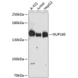 Western Blot - Anti-NUP160 Antibody (A88347) - Antibodies.com