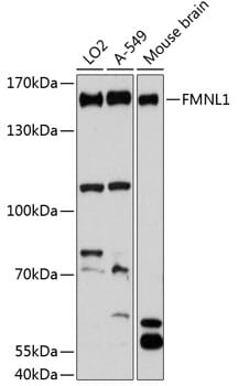 Western blot analysis of extracts of various cell lines, using Anti-FMNL1 Antibody (A13010) at 1:3000 dilution.
Secondary antibody: Goat Anti-Rabbit IgG (H+L) (HRP) (AS014) at 1:10,000 dilution.
Lysates / proteins: 25µg per lane.
Blocking buffer: 3% non-fat dry milk in TBST.
Detection: ECL Basic Kit (RM00020).
Exposure time: 90s.