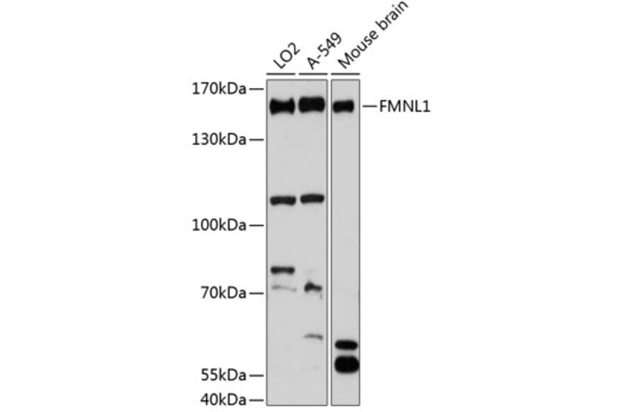 Western Blot - Anti-FMNL1 Antibody (A88351) - Antibodies.com