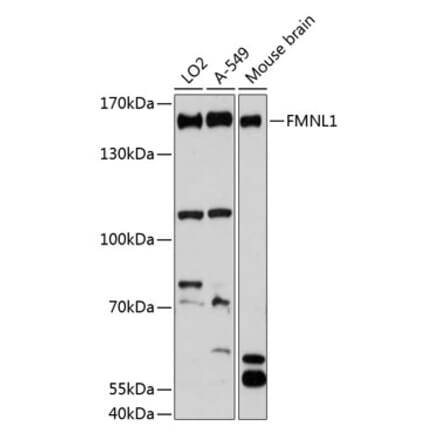 Western Blot - Anti-FMNL1 Antibody (A88351) - Antibodies.com